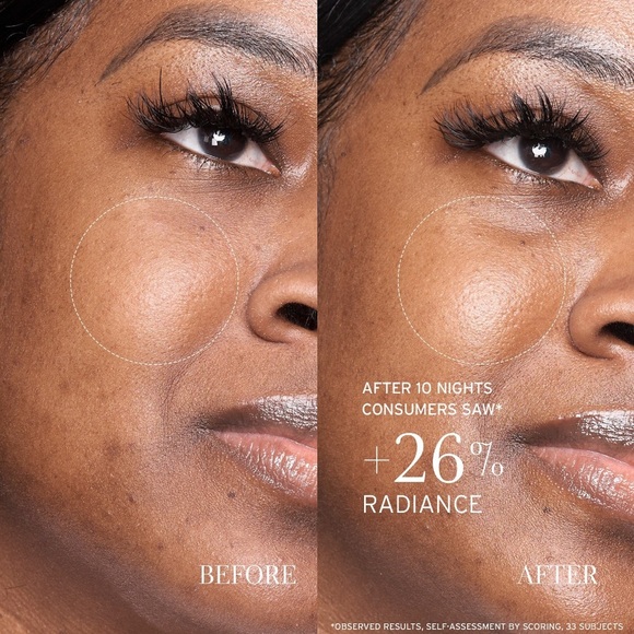 🪷 Fresh Lotus Youth Preserve Resurfacing Dream Serum - Picture 6 of 8